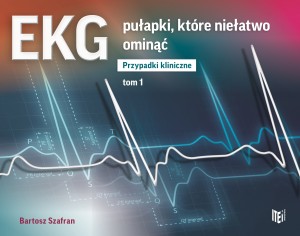 43935a5-ekg-pulapki-ktore-ni