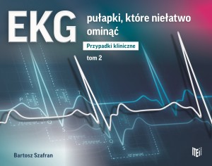 7eb250f-ekg-pulapki-ktore-ni